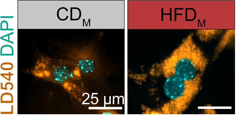 Liver cells store more lipids (yellow, LD540) when exposed to molecules from Kupffer cells taken from the offspring of obese mice (right, HFDM). Left: Liver cells exposed to factors from offspring of normal-weight mothers (CDM). 