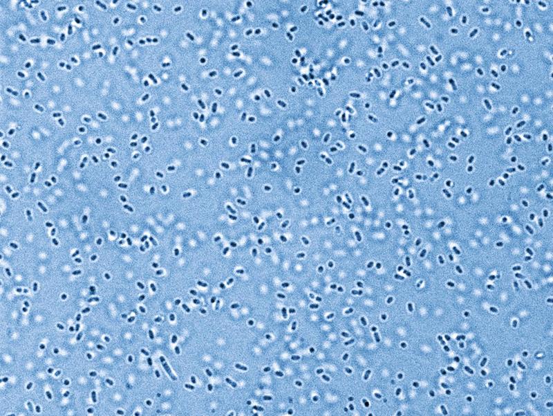 Pandoraea bacteria