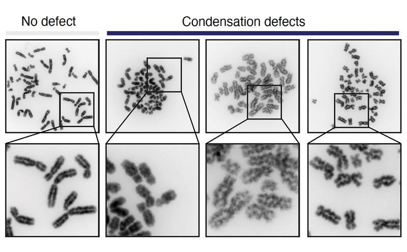  Images of chromosome spreads without (left) and with condensation defects (right)
