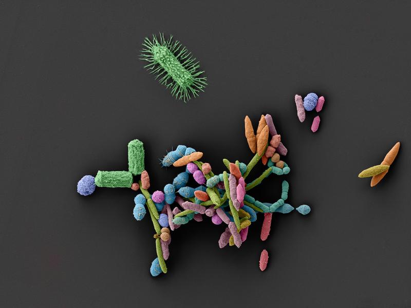 These interacting microorganisms form an ecosystem that is vital to human health. Medications can severely disrupt this fragile balance – they eliminate beneficial bacteria and thereby promote the growth of harmful species.