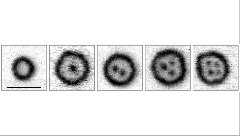 Abb. 2: Röntgenmikroskopische Aufnahmen der Magnetisierungstexturen