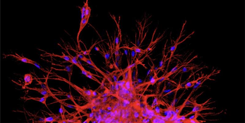 Max Planck scientists are using magnetic nanoparticles to study how physical forces influence the way new blood vessels grow. In this microscope image, tiny blood vessel sprouts (red with blue cell nuclei) are seen growing out of 3D spheroid tissue models