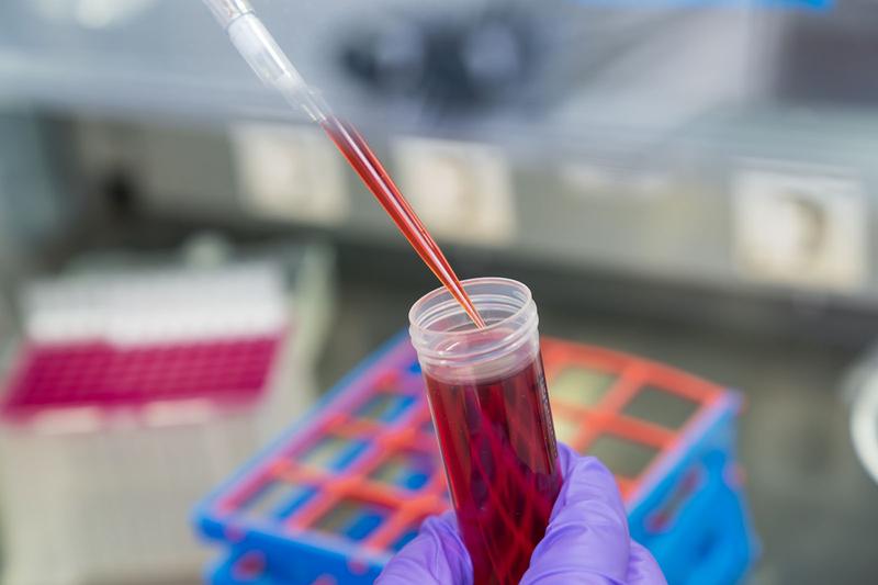 Für das neue, nicht invasive Diagnostikverfahren wird zellfreie DNA aus dem Blut von Patienten isoliert. 