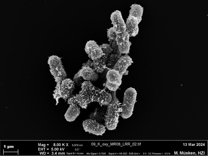 Elektronenmikroskopische Aufnahme von Klebsiella oxytoca