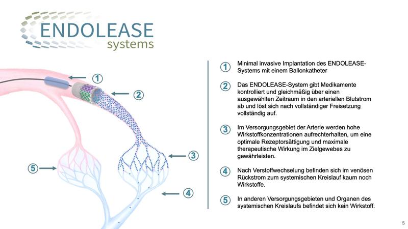 Funktionsweise des ENDOLEASE Systems