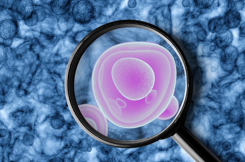 Vereinfachte Darstellung einer Uteruskarzinomzelle