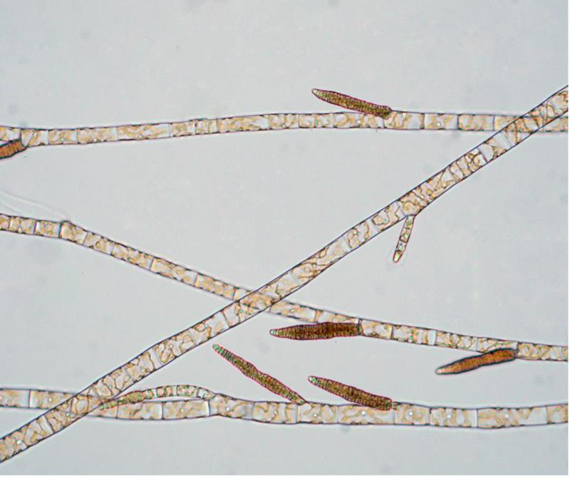 Mikroskopische Aufnahme von Braunalgen 