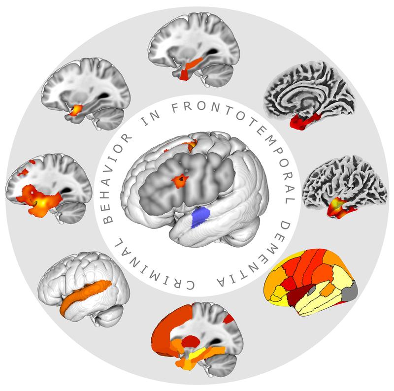 criminal behavior in patients with dementia 