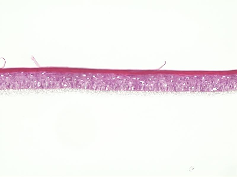 epiCS® - menschliche Epidermis, rekonstruiert aus primären menschlichen Keratinocyten