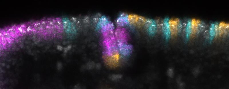Genexpression in der Kopffurche eines Embryos von Drosophila melanogaster. Die Zellkerne sind grau dargestellt, die Farben zeigen, wo die Gene slp1 (cyan), btd (magenta) und eve (gelb) exprimiert werden.