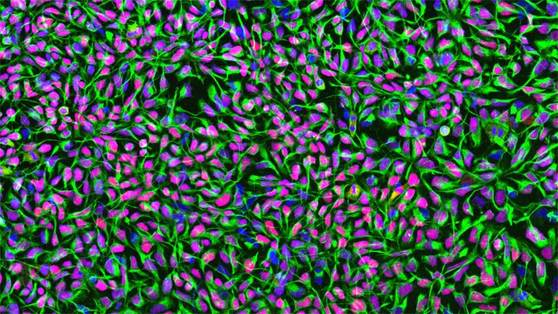 Humane neuronale Stammzellen in Zellkultur