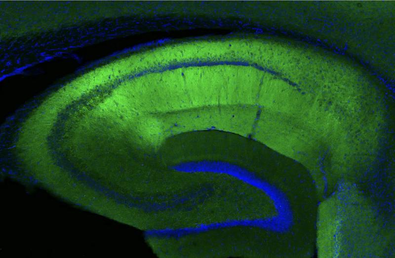 Fluorescence image of a mouse hippocampal slice. Synapses are shown in green, and blue marks the cell bodies of neurons. 