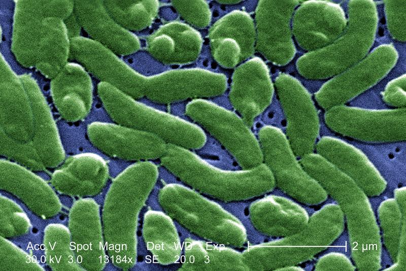 Können für Menschen potenziell sehr gefährlich sein: Bakterien der Art Vibrio vulnificus (hier eine Rasterelektronenmikroskop-Aufnahme)