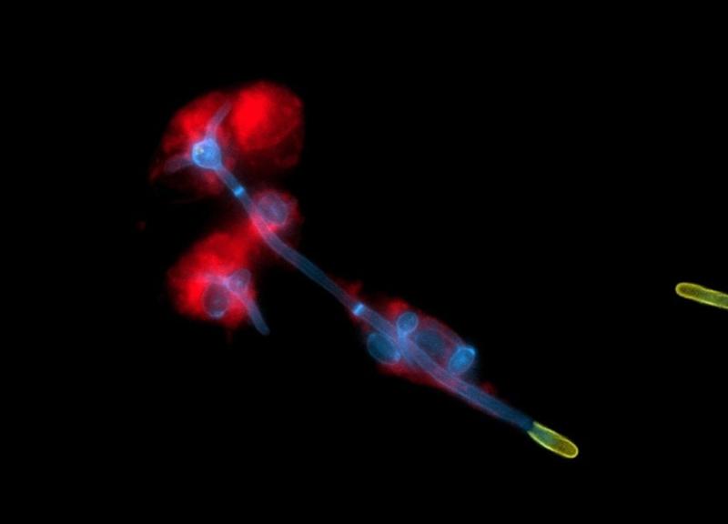 The yeast fungus 𝘊𝘢𝘯𝘥𝘪𝘥𝘢 𝘢𝘭𝘣𝘪𝘤𝘢𝘯𝘴 (blue) breaks out of human immune cells (red) by forming long thread-like cells called hyphae. The part of the hypha that has already left the immune cells is colored yellow. 