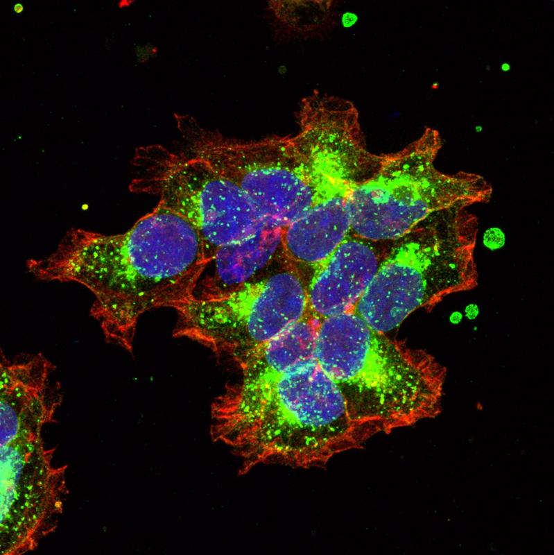 Cluster von Zellen mit grün markierten Oxytocinrezeptoren, rot markierter Zellmembran und blau markierten Zellkernen. Diese Zellen wurden für die Experimente verwendet.