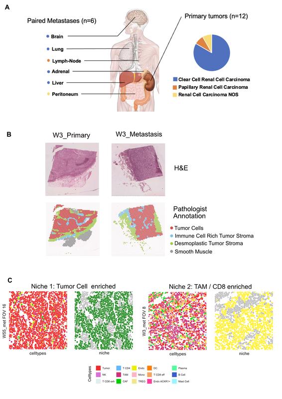A – Ursprungsorte der Proben, B – Histologische Schnitte der Tumorproben mit entsprechenden Auflösung durch räumliche Transkriptomik-Technologie., C – Immunnischen und Ansprechen