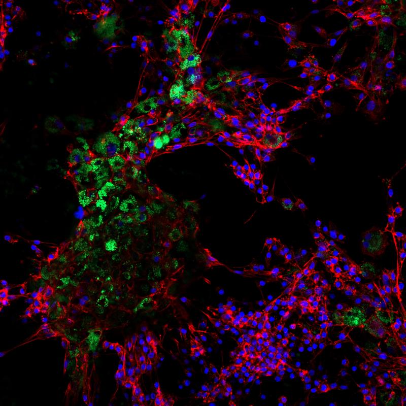 Granulosa cells from bovine ovaries after eight days of contact with nanoplastics particles. The fluorescent polystyrene particles (100 nm) show how the cells absorb the nanoplastics. 