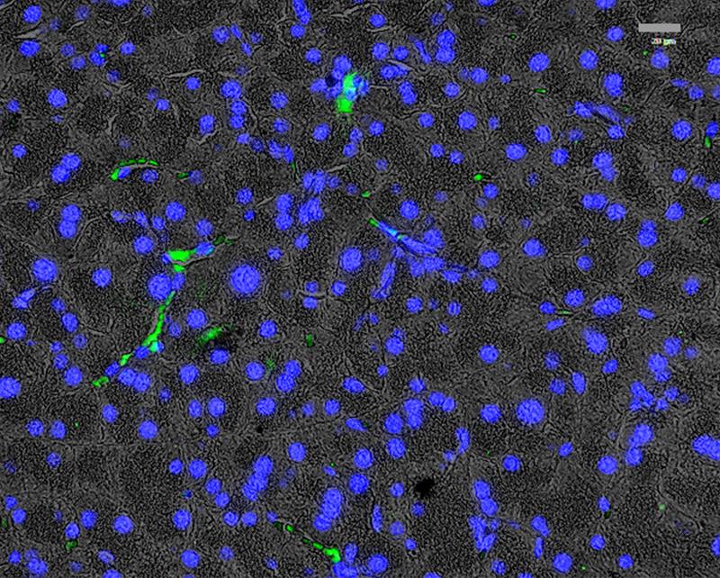 Immunfluoreszenz-Bildgebung der Expression des Platelet-derived growth factor α (PDGFRα) in exokrinen Bereichen von histologischen Pankreas-Schnitten.