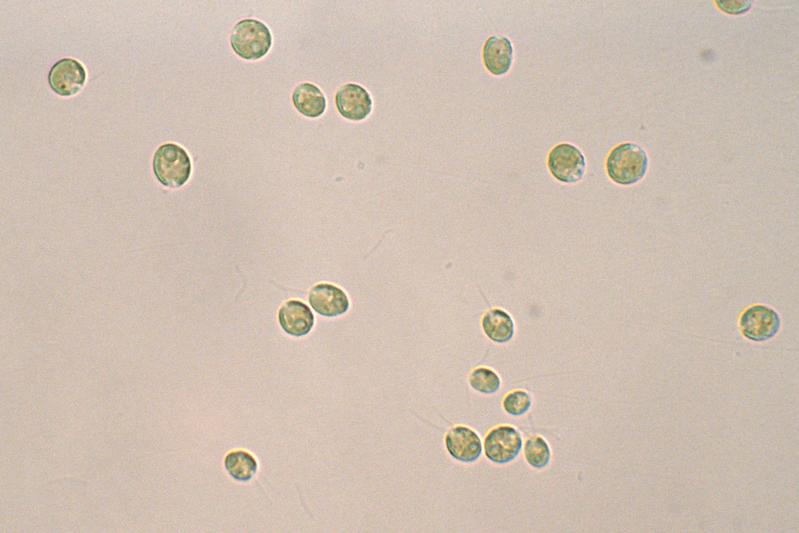  Lichtmikroskopische Aufnahme von Chlamydomonas reinhardtii