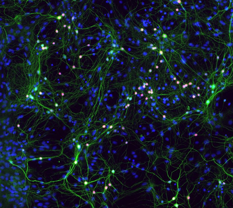 Nerve cells (green) form neural networks in which information is transmitted. Errors in this communication can lead to neurodegenerative, neurological, and neuropsychiatric diseases.