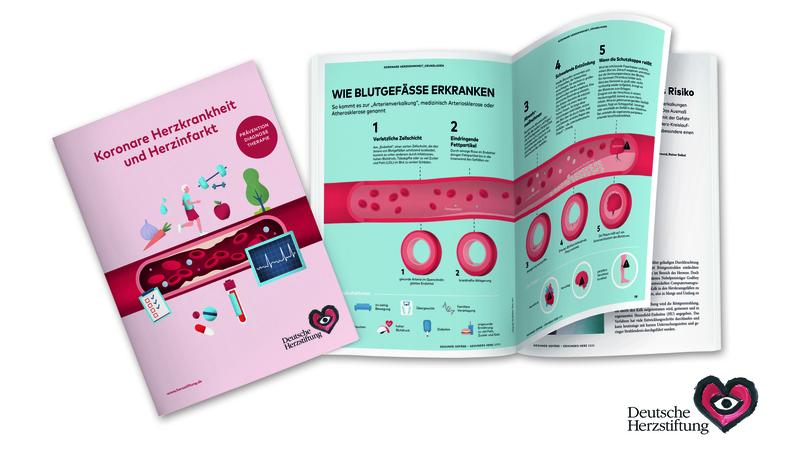Neue Broschüre der Herzstiftung: Koronare Herzkrankheit und Herzinfarkt