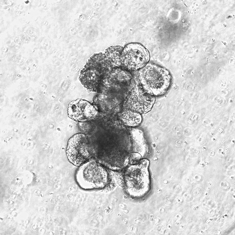 Moderne Organoidkulturen - kleine „Mini-Därme“ - werden im Labor aus menschlichen Stammzellen hergestellt.