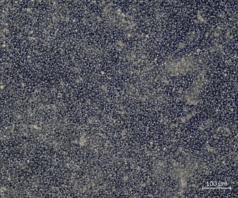 When CDX2 is turned off, the cells produce the typical bile ducts seen in liver cells.