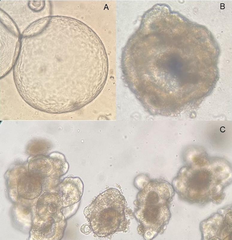 Mikroskopische Aufnahmen patientenspezifischer Organoidkulturen_UMMD