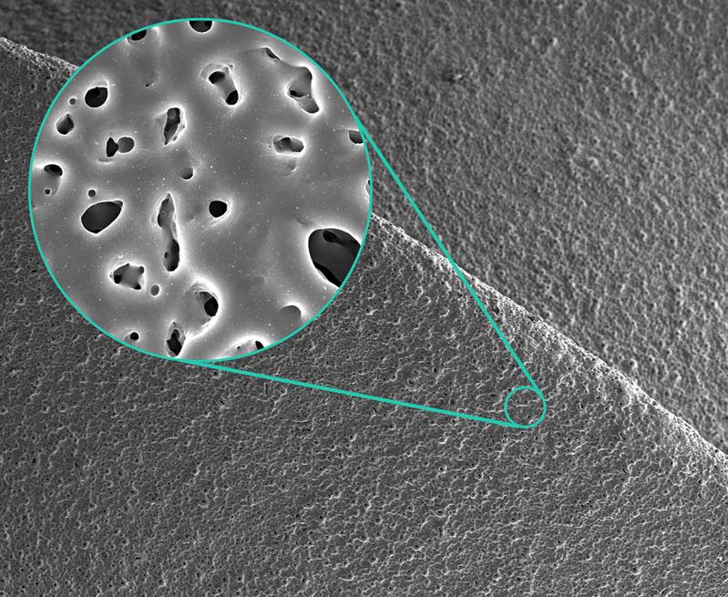 Scanning electron micrograph of a silver-doped porous micro-arc oxide layer on titanium 