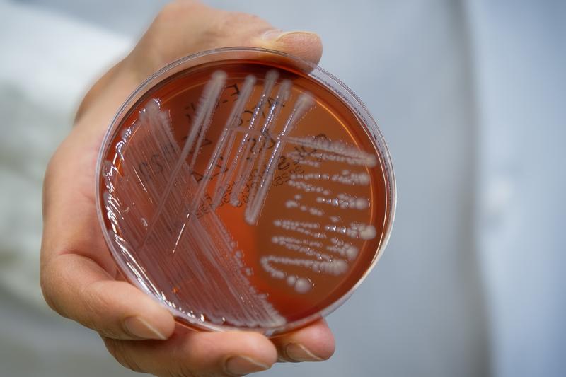 Durch neue Entwicklungen in der klassischen Kulturtechnik können Bakterien erforscht werden, die bislang im Labor kaum gezüchtet werden konnten. 