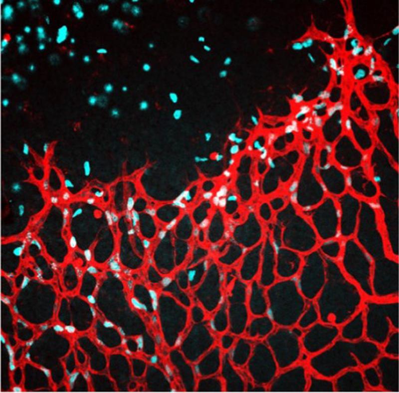 Die Abbildung zeigt eine Retina der Maus nach der intravitrealen Injektion von NaCl als Kontrolle.