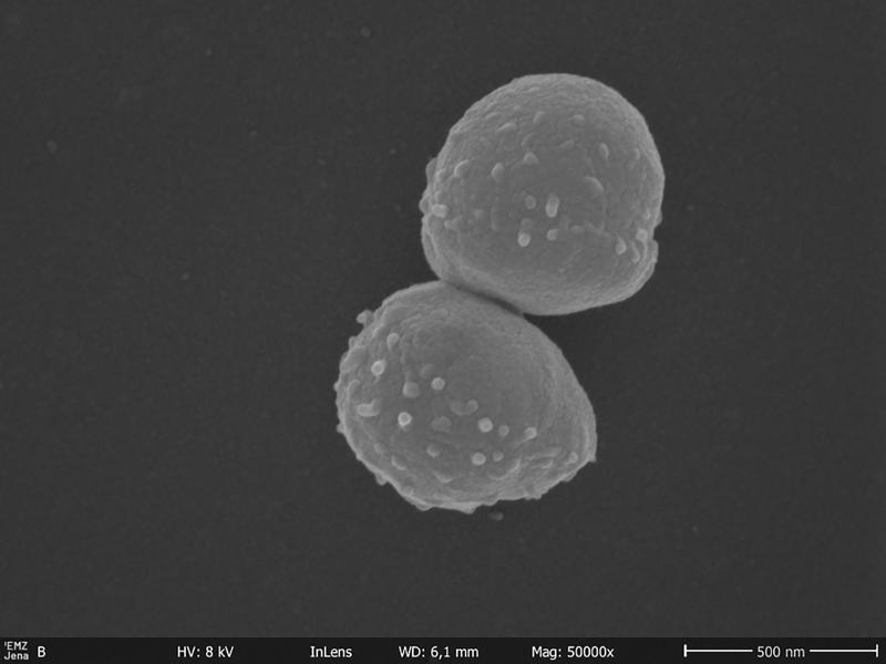 Aufnahme eines Rasterelektronenmikroskops von winzigen Zellen aus Grundwasserproben, die im Labor kulturviert wurden.