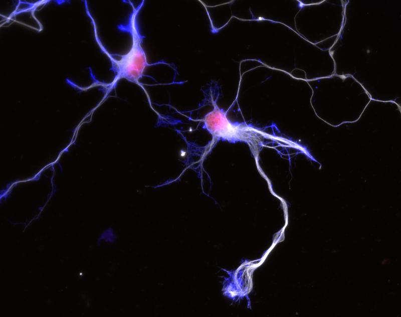 Immunostaining von kultivierten Neuronen (rot: Zellkern; weiß: Tubulin, blau: Aktin)