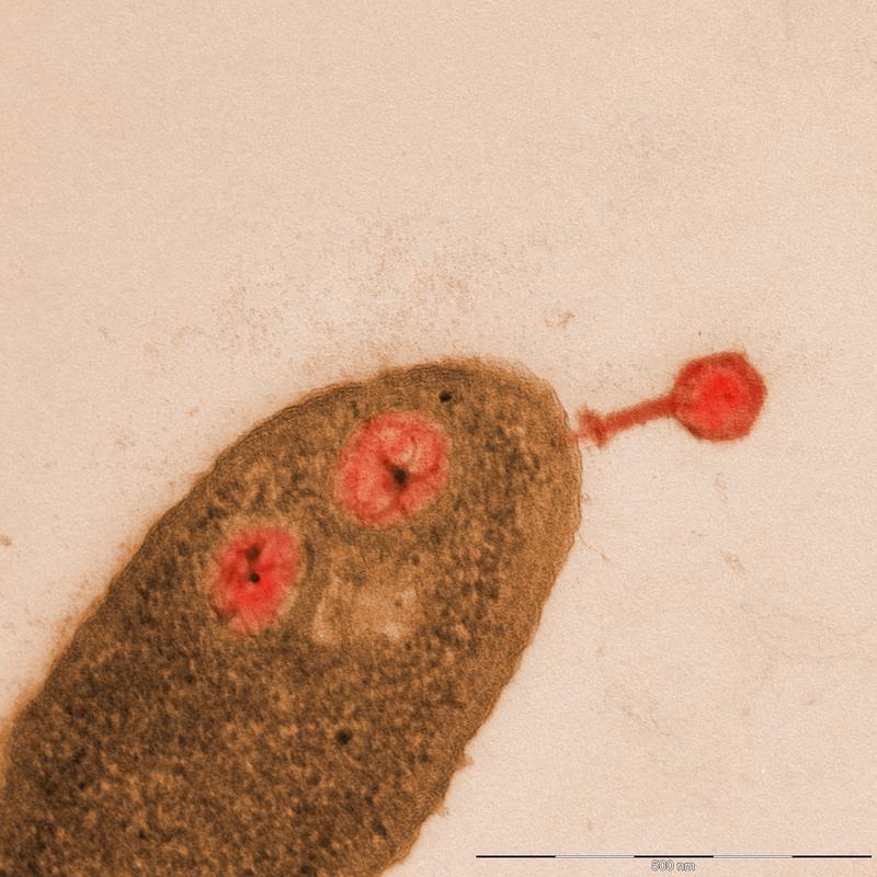Electron micrograph of Pseudomonas aeruginosa infected by the jumbo phage ΦKZ (red). 