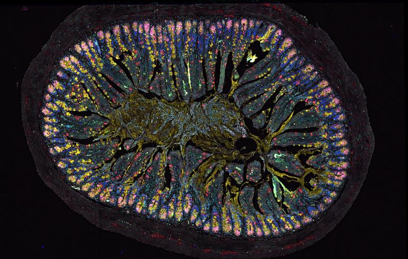 Gewebeschnitt aus dem Darm einer Maus, die das Neuropeptid nicht bilden kann: Zelltypen wie Büschelzellen (rot), schleimproduzierende Becherzellen (gelb), Paneth-Körnerzellen (pink) und Stammzellen (grün) treten auffallend häufig auf.