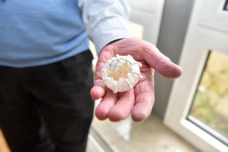 So sieht die Klappenprothese aus, die im Herzen von Hans-Peter Wetzig implantiert wurde. 