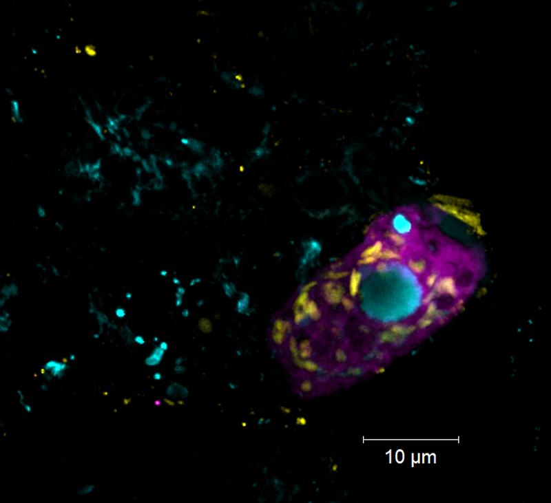 The endosymbiont Candidatus Azoamicus mariagerensis and its ciliate host under the fluorescence microscope. Visible is the endosymbiont (stained yellow), and the ciliate host (stained purple). The ciliate nucleus is stained with a DNA stain (in blue). 