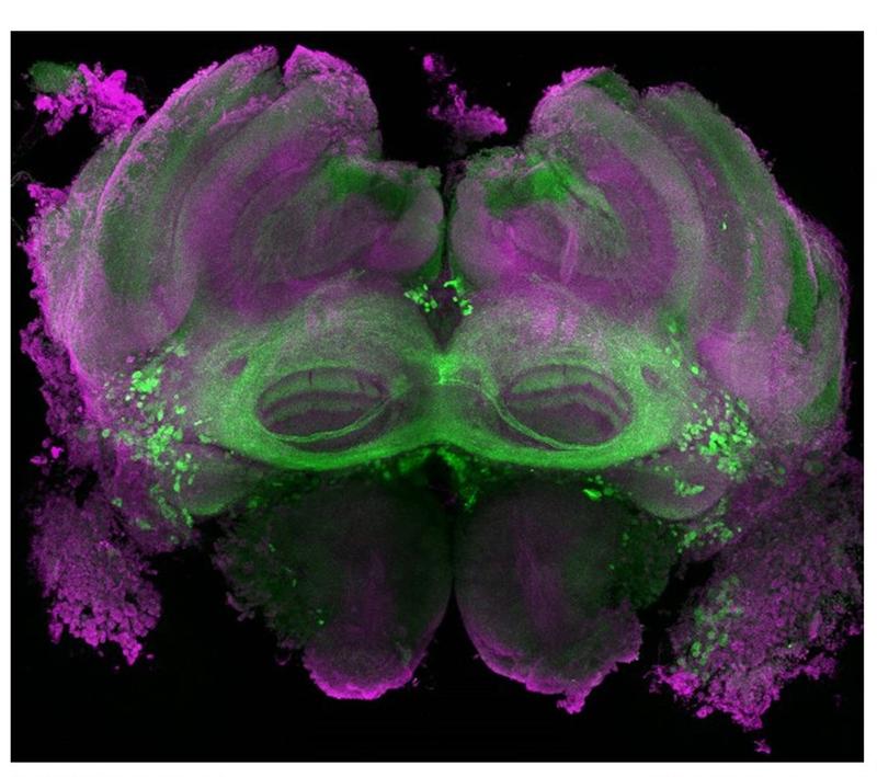 Microscopic view of the drone’s brain (purple): The neurons belonging to the Fru circuit, which is involved in the animals’ begging behaviour, are marked in green.