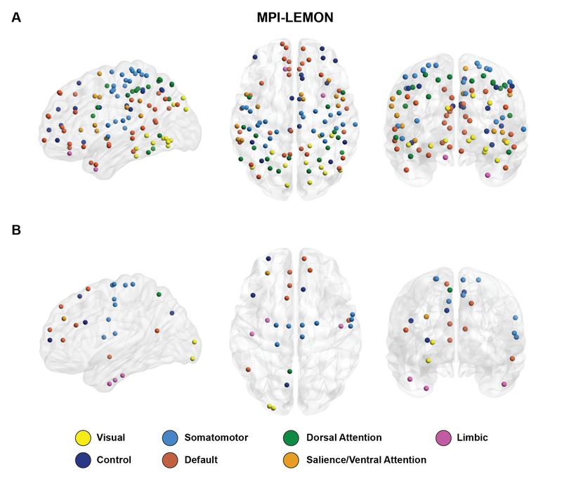 Visual representation of brain regions with significant between-group differences in node persistence