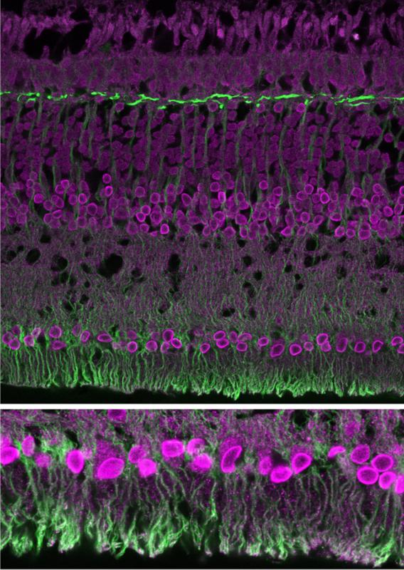 Mithilfe von Antikörpern gelang der Nachweis, dass die „Füße“ am unteren Ende der Stützzellen in der Netzhaut von Zebrafinken, die sogenannten Müller-Zellen (grün), Enzyme zum Abtransport von Laktat enthalten (violett). 