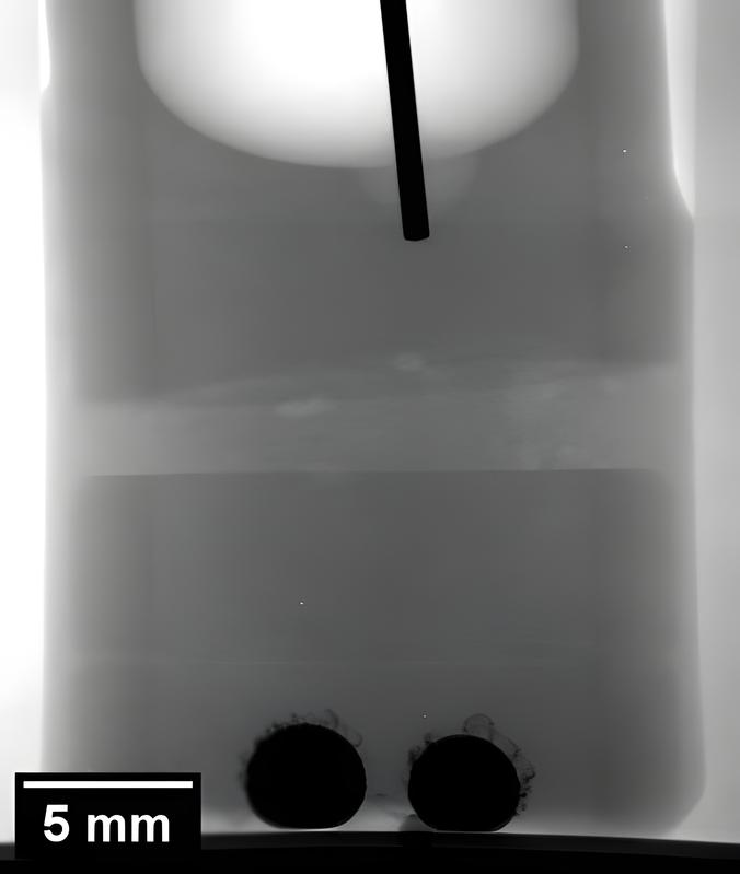 X-ray radiography of a sodium-zinc cell with sodium anode