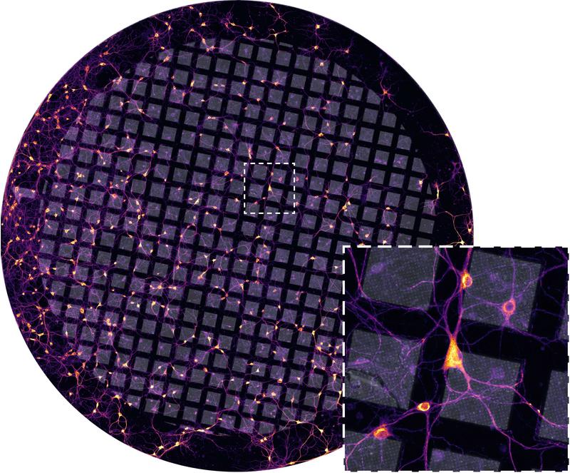 Primary rat hippocampal neurons grown on an electron microscopy support grid prior to plunge-freezing and cryogenic electron tomography. The neurons are visualized using staining with a neuron-specific dye. Grid diameter = 3 mm