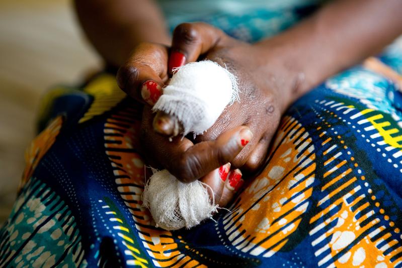 Leprosy in DR Congo - 2013