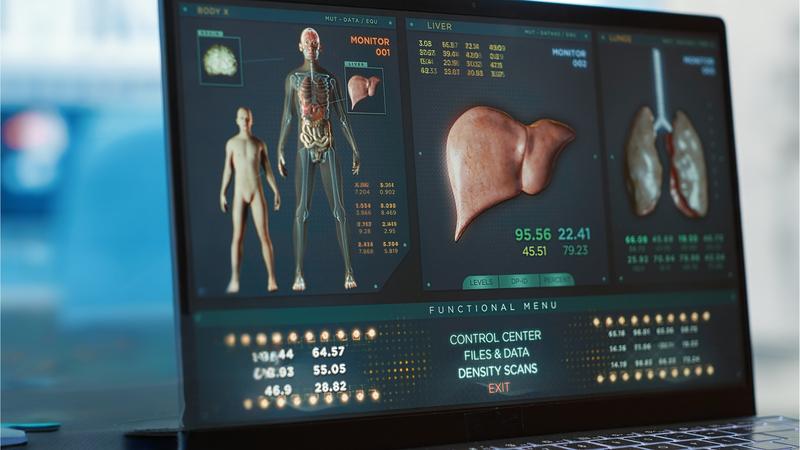 Studie zeigt zuverlässigen Risikoscore für Leberkrebs auf Grundlage von routinemäßig erhobenen Gesundheitsdaten.