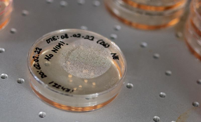 Gehirnorganoide in einer Petrischale