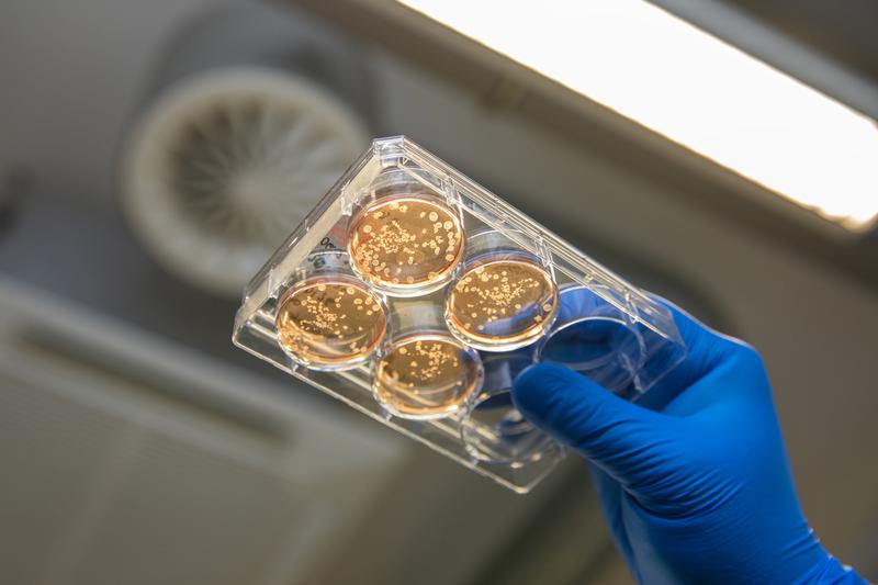The white cell clusters in the red culture medium produce macrophages (phagocytes).