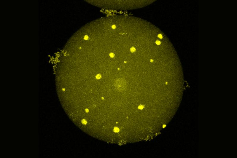 In mikroskopischen Untersuchungen entdeckte das Forschungsteam autofluoreszierende Partikel mit einer ausgeprägte Kristallstruktur auf zellulärer Ebene, die mit Carotinoid-Kristallen aus Chromoplasten vergleichbar sind.