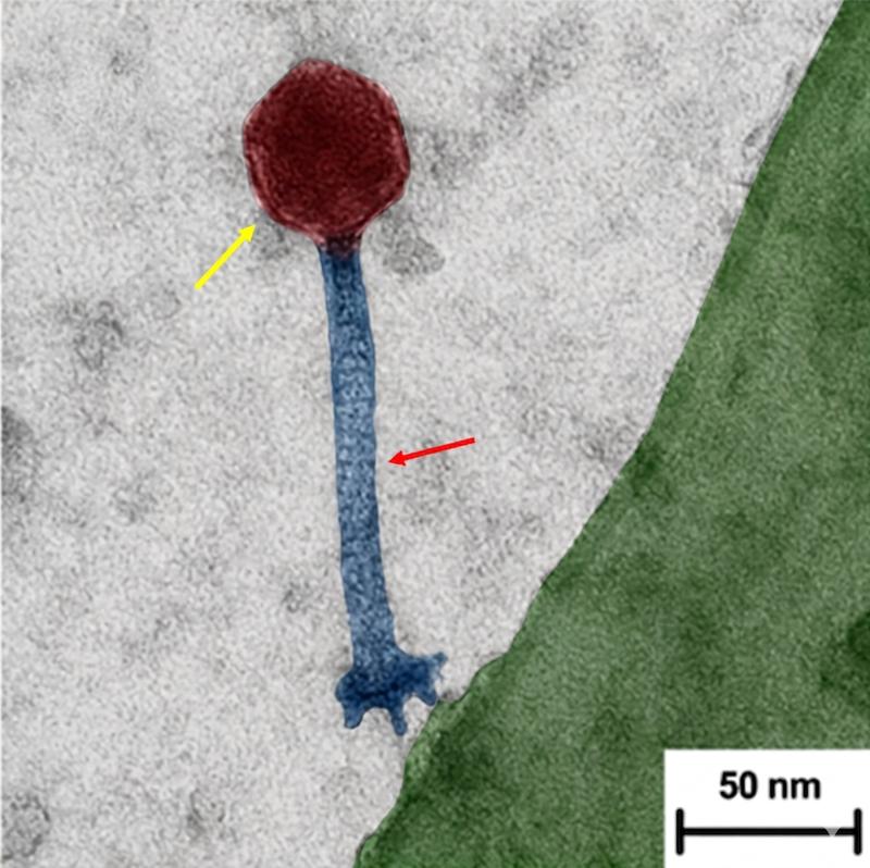 Elektronenmikroskopisches Bild eines Phagen, nachgefärbt. 