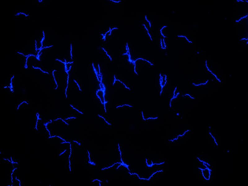 Der blau fluoreszierende Erreger Borrelia recurrentis in Kultur..