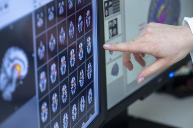 Analysis of brain scans obtained using fMRI (representative image)